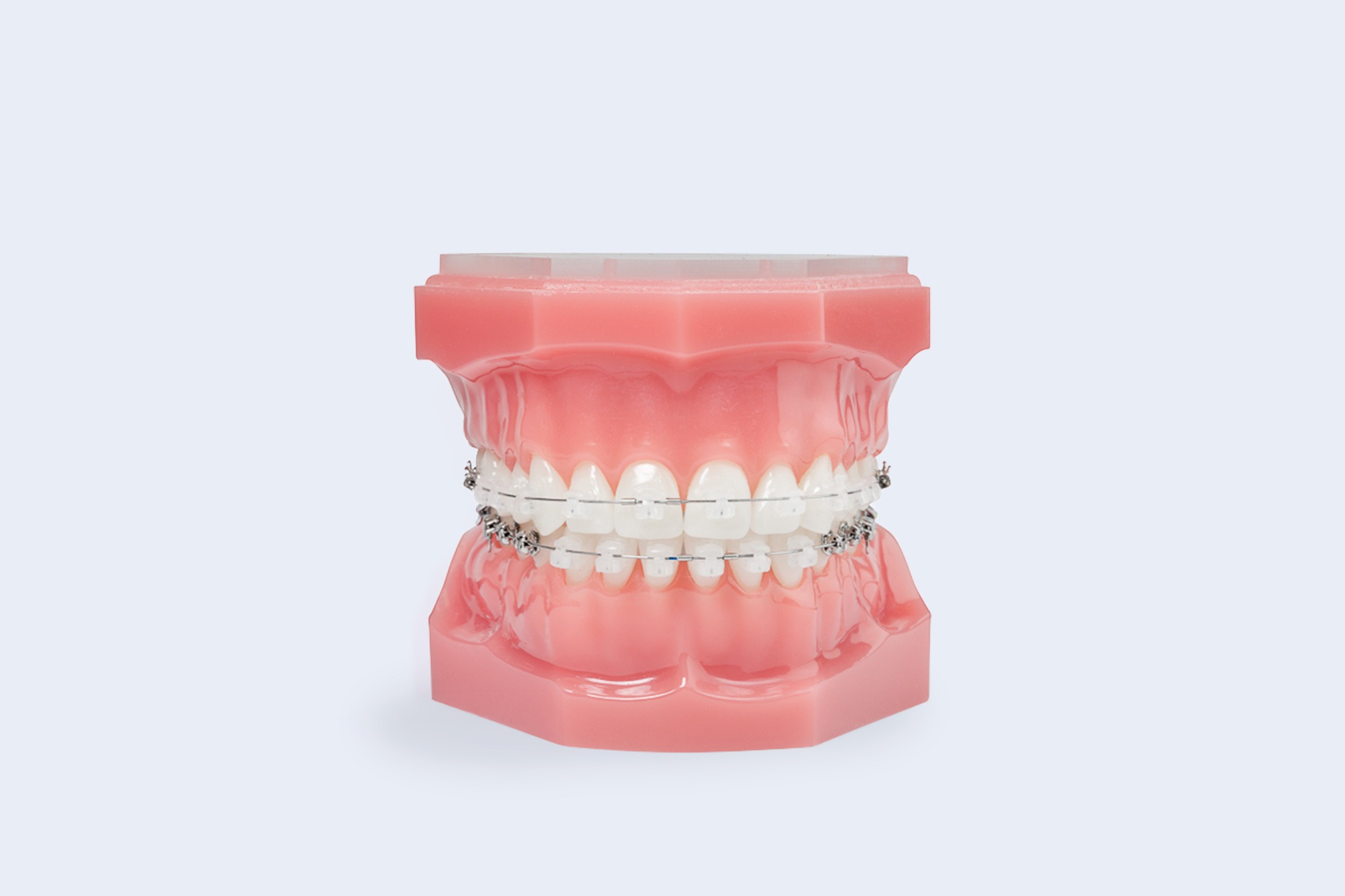 Clear Braces Hot Springs Clear Braces Hall Orthodontics