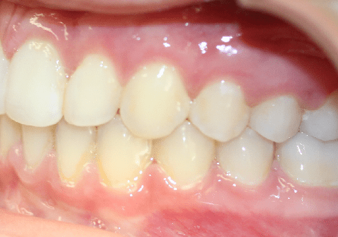 Arkadelphia AR Orthodontics