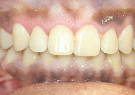 Arkadelphia AR Orthodontics